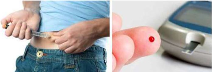 Diabetus Mellitus da İnsülin uygulama ve glikoz takibi